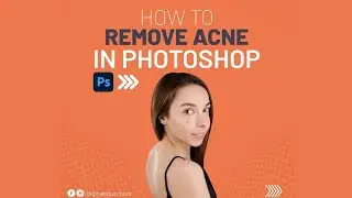 How to remove acne from images using Photoshop
