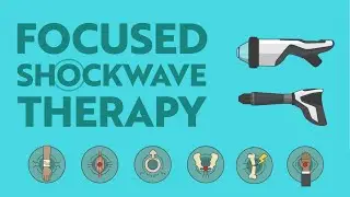 Focused Shockwave Therapy - What is it & How Can it Help?