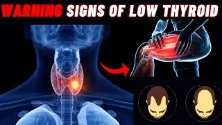 Hypothyroidism Symptoms | Signs of Low Thyroid | Symptoms of Hypothyroidism