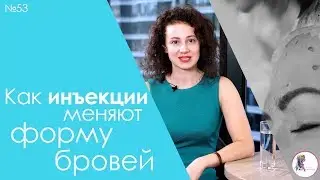 Как изменить форму бровей с помощью инъекций?