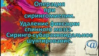 Операция при сирингомиелии. Устранение фиксации спинного мозга, шунтирование кисты. Нейрохирургия
