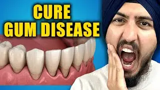 How to Reverse Gum Disease AT HOME