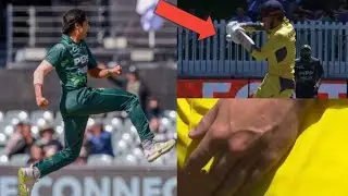 Mohammad Hasnain Breaks Left Hand Of Cooper Connolly In Australia Vs Pakistan Perth ODI 2024 😲😲😲