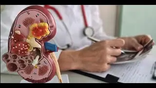 Nutcracker Syndrome: Anatomical, Physiological and Clinical Correlations
