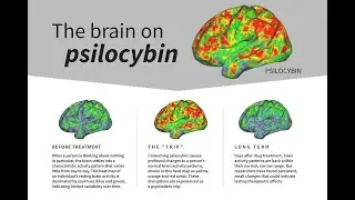 Psilocybin desynchronizes the human brain