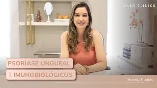 [Caso Clínico] Psoríase ungueal e o tratamento com imunobiológicos