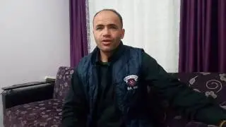 Saç çıkarma formülü