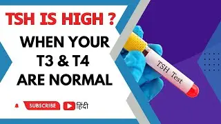 TSH IS HIGH MEANS? WHEN YOUR T3 & T4 IS NORMAL