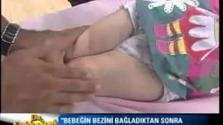 Dr. Feridun Kunak Show B4 (Bebeklerde Oluşabilcek Kalça Çıkıklığı ve Masajı)
