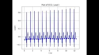 Digital Signal Processing Using Python: Chapter 1: Part5