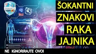 Šokantni Znakovi Raka Jajnika Koji Mogu Promijeniti Vaš Život!Dr#121