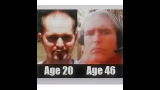 Facial Bone Development , Height Growth / An Authentic Discussion