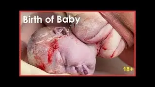 How to Give Birth Without Pain Medication