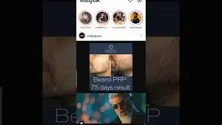 INSTAGRAM WITHOUT TAG TRICKS 😂😜