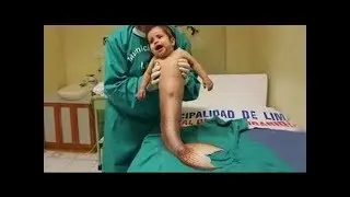 Meerjungfrau Baby geboren Sie werden nicht glauben