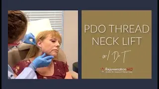 PDO Thread Neck Lift