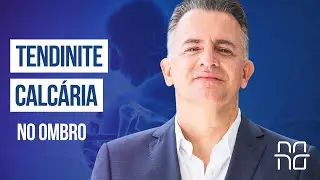 TUDO SOBRE A TENDINITE CALCÁRIA NO OMBRO