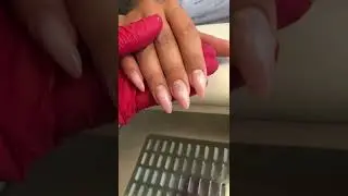 Вниз растущие ногти