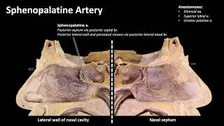 Maxillary Artery