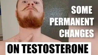 Some of the PERMANENT changes on testosterone // FTM transgender
