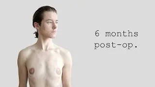ftm: 6 months post-op.