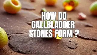 How Do Stones Form in the Gallbladder ?