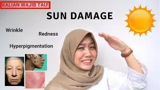 All About Sun Damage and How to Avoid it (Darkspot, Wrinkle, Redness) and How to Avoid it