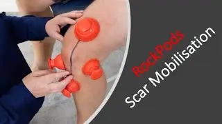 Scar Massage for Knee Scars with RockPod (Dry Cupping Therapy)
