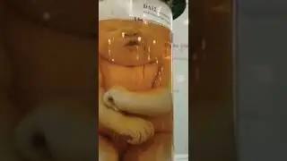 Different type of child specimen with different diseases 😯😲😳😳 ⚕️⚕️ 