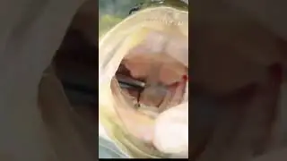 How to Remove a Deeply Hooked Fish - The Safe Way