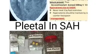 Sub_Arachnoid Hemorrhage treatment. its important to give Pletaal..watch with full screen