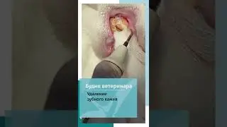 Удаление зубного камня