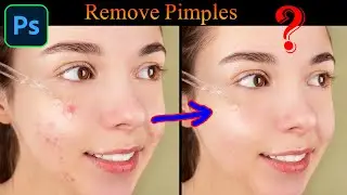 Remove Pimple, High End Skin Retouching, Skin Softening in Photoshop,