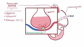 [Tim mạch] cơ chế suy tim sung huyết,triệu chứng Congestive heart failure CHF