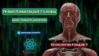 Трансплантация головы. Head transplantation