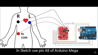 [SOURCE CODE] Heart Rate Using Sensor AD8232 ECG using Arduino Mega, Uno 100 Hz