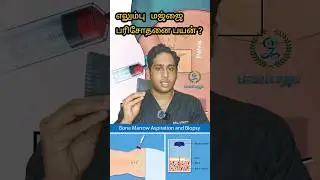 எலும்பு மஜ்ஜை பரிசோதனை என்றால் என்ன|Bone marrow aspiration|Bone marrow biopsy #bonemarrowaspiration