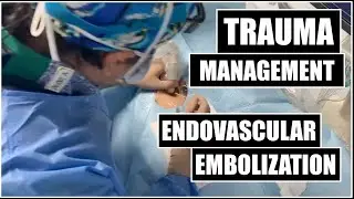 Interventional Radiology Management of Bleeding after Trauma: Embolization Procedure