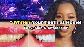 How to Whiten Teeth at Home Fast & Safely | Best Teeth Whitening Tips & Remedies