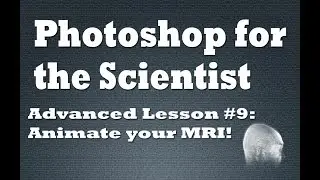 Animate your MRI in Photoshop
