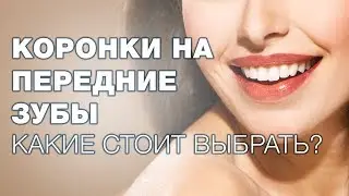 Какие коронки выбрать на передние зубы? Как выбрать коронки?