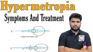 Hypermetropia|| What is hypermetropia|| treatment of hypermetropia Symptoms And Treatment