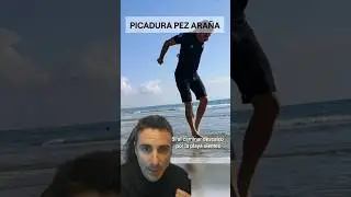 Te pica un pez araña.