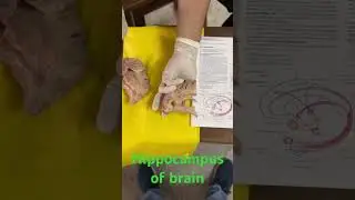 Hippocampus of Brain