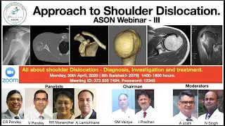 ASON webinar 3: Approach to Shoulder Dislocation