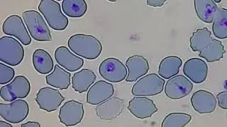 Babesia canis