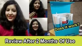 Review After USE of SkinKraft by Kanika | Genuine Review