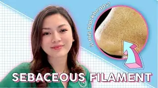 Beauty Tips || Sebaceous Filament : Is This Blackheads?