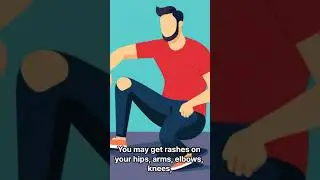 What's hand and foot disease
