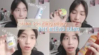 6 DỤNG CỤ VỆ SINH CHO RĂNG NIỀNG | Furthermine